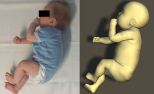 Skinned Multi-Infant Linear Model (SMIL)